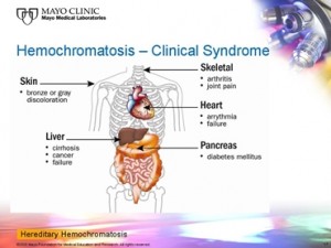 hemochromatosis 14